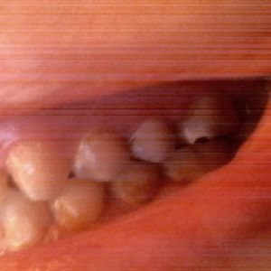 Meet your Posher, Elegy